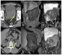 Image result for Incidental Imaging Finding