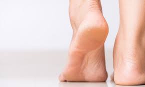 Hiperglikemia utrzymująca się przez dłuższy czas, doprowadza do uszkodzenia naczyń krwionośnych (szczególnie tętnic), co skutkuje zmniejszeniem ich elastyczności, zarastaniem i nasiloną miażdżycą.z powodu niedokrwienia tkanek stopy dochodzi do zaburzeń ich czynności. Stopa Cukrzycowa Objawy I Leczenie Blog Apteka Melissa