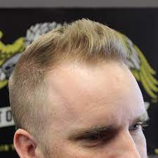 10 Best Hairstyles For Balding Men Balding Mens Hairstyles Haircuts For Balding Men Hair Loss Men