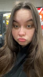 What can help with severe pigmentation issues?