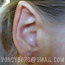 Join my mailing list through the portal below. Healed Ear Pointing By Samppa Von Cyborg Body Modification Piercings Body Mods Body Modifications