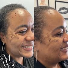 Monique Whitehurst-FNP, Aesthetic Injector/Trainer💉