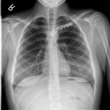 Image result for SC Dislocation