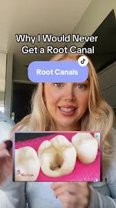 Addy Kate Root Canal