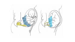 Forward-leaning Inversion - Technique for Easier Birth - Spinning Babies