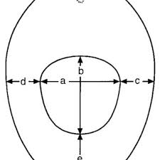 As a boy becomes more aware of his body, he will most likely discover how to retract his own foreskin. Measurement Of The Hymen In The Supine Position A Transverse Download Scientific Diagram