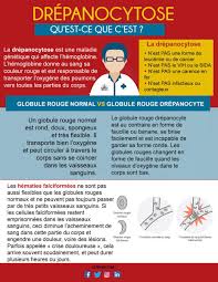 И что же это за вещь, которой мы все поглощены, и озабочены? Les Zopitaux Et Moi Auf Twitter La Drepanocytose Qu Est Ce Que C Est C Est Pas Un Cancer C Est Pas Le Vih C Est Pas Une Carence En Fer
