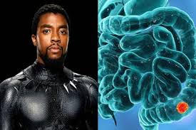 Colorectal cancer is more likely to cause symptoms in later stages once the cancer has grown or spread. All About Colon Cancer Symptoms And Treatment Of Disease That Took Black Panther Aka Chadwick Boseman S Life