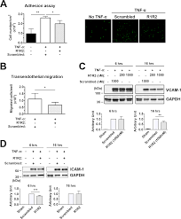 Maybe you would like to learn more about one of these? Plos One Collagen Inhibitory Peptide R1r2 Mediates Vascular Remodeling By Decreasing Inflammation And Smooth Muscle Cell Activation