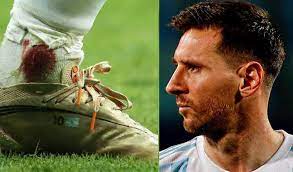 Así quedó tras una plancha de frank fabra. Flkigudjk 3 M