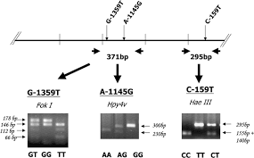 Vaata martin joller profiili sportos portaalis. Association Of Cd14 Promoter Polymorphisms And Soluble Cd14 Levels In Mite Allergen Sensitization Of Children In Taiwan Journal Of Human Genetics