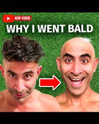 What to make of baldness in men?