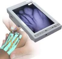 Amazon.com: OROMMA Infrared Vein Finder Locator Vein Viewer ...