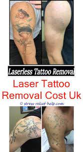 It shatters the ink into smaller particles without damaging the surrounding skin for your body. New Laser Tattoo Removal Has Robbie Williams Had Tattoos Removed Will Goat Milk Remove Tattoos Painless Tattooentfernung Tatowierungen Temporare Tatowierung