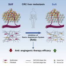 Adults who should be getting screening colonoscopies are avoiding this procedure, says the centers for disease control and prevention. Reduction Of Liver Metastasis Stiffness Improves Response To Bevacizumab In Metastatic Colorectal Cancer Sciencedirect