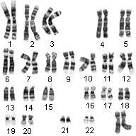 Chromosomes Involved In Color Blindness Colblindor