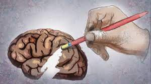 The clinical introduction of genetic testing for alzheimer disease. Krankheiten Alzheimer Krankheiten Gesellschaft Planet Wissen