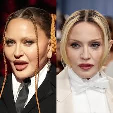 Reason 5,997,567 why I loathe volume. It also makes people look  unidentifiable! Gravity and laxity are truly the most important to address  and correct. Plus good skincare. I am loving this makeunder