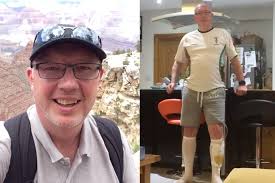 Fit and healthy' rugby coach had part of his penis amputated due to cancer  at just 46