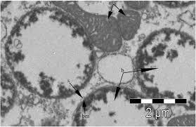 Image result for Buchnera