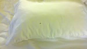 3737 west chapman avenue, orange, ca 92868, usa. Bed Bug On Pillow Picture Of Holiday Inn Express Suites Garden Grove Anaheim South Tripadvisor