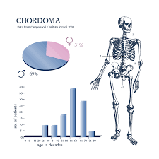 These include the patient's age, type of chordoma, size and location of the tumor, method of treatment, extent of resection, and other factors. Chordoma Bonetumor Org