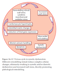Image result for Systolic Dysfunction