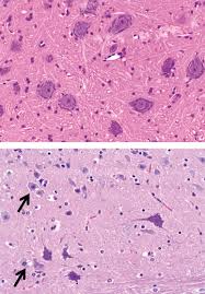 There are two types of cells that compose nervous tissue: Nerve Tissue An Overview Sciencedirect Topics