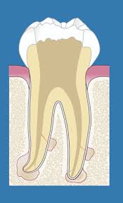 Crest.com has been visited by 10k+ users in the past month Root Canal Treatment Praxis Am Kureck