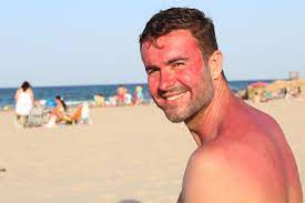 How to get rid of red face from viagra. Rosy Cheeks Causes And What To Do