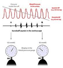 Sudden drops in blood pressure most commonly occur in someone who's rising from a lying down or. Blood Pressure Wikipedia