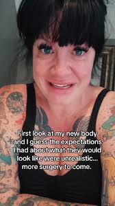 Breast Cancer Reconstruction Surgery Expectations