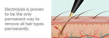 Today's medical electrolysis devices destroy the growth center of the hair with chemical or heat energy. Electrolysis Hair Removal Diathermy Skin Clinic