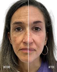 Stephanie Squires (@aesthetics_bysteph) • Instagram photos and videos