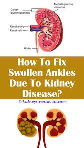 Epingle Sur Kidney Disease Disorders