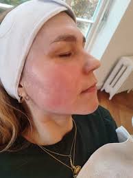 Ich möchte, dass meine Haut so lange wie möglich gesund und vital bleibt“