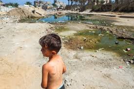 Image result for Polio