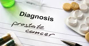 (2014 photo by jeff pachoud/afp. Six Questions To Ask Your Doctor About Prostate Cancer Treatment Ctca
