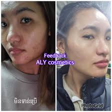 ALY Cosmetics CO., LTD