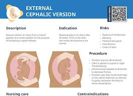 Image result for External Cephalic Version