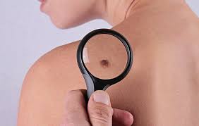 They are due to the development of abnormal cells that have the ability to invade or spread to other parts of the body. 5 Signs Of Skin Cancer That Are Easy To Overlook Bicycling