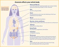Eating Disorders Anorexia Bulimia Disorder Eating Eng