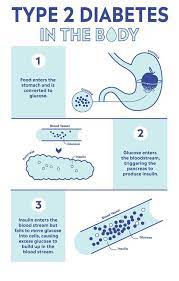Pin On Type 2 Diabetes Medical Info