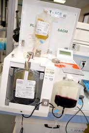 Image result for Apheresis