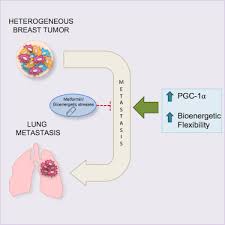 Invasive ductal carcinoma (idc), breast cancer recurrence, papillary breast cancer. Pgc 1a Promotes Breast Cancer Metastasis And Confers Bioenergetic Flexibility Against Metabolic Drugs Sciencedirect
