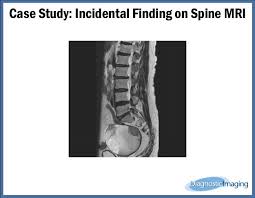 Image result for Incidental Imaging Finding