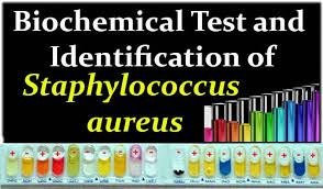 Biochemical Test And Identification Of Staphylococcus Aureus