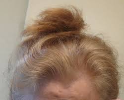 Run to the store (or have someone buy it for you, so you don't have to leave the house) and grab a box of hair dye that is the closest to the color your hair was before you bleached it. Orange Hair Misadventures In Going Natural From Dark Brown Part Iii With Christian Eyes