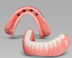 Blog - Triple T International Dental Laboratory