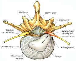 Image result for vyhřezlá ploténka